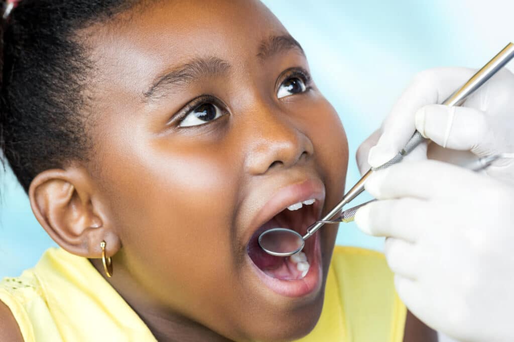 How to Prevent Toddler Tooth Decay